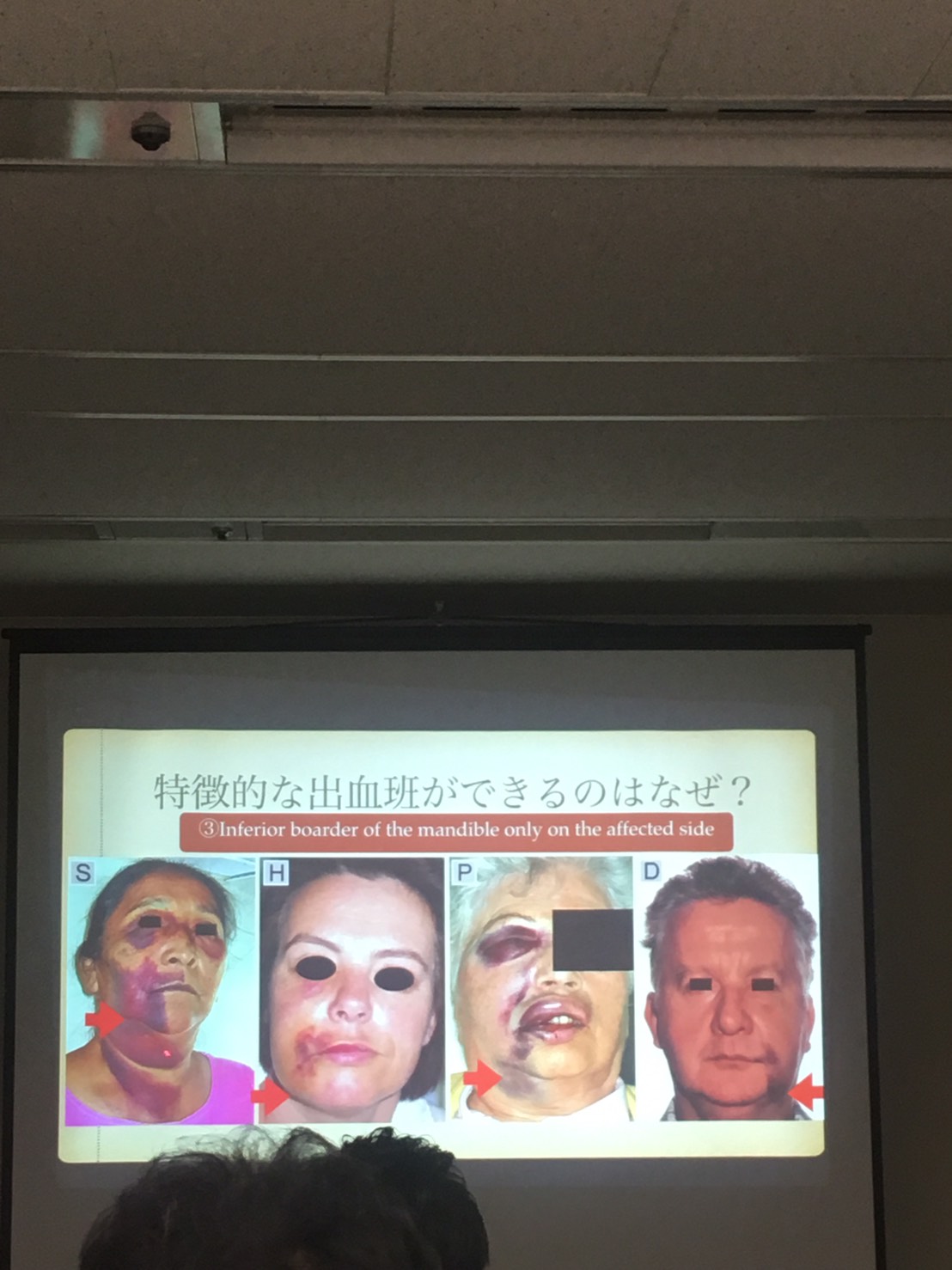 tmp_1950-1483075858788-909455376