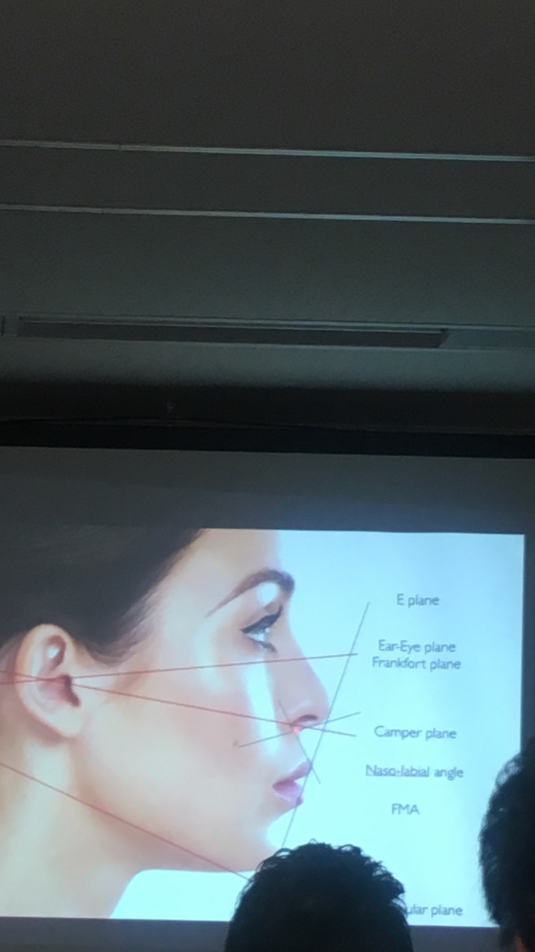 tmp_1950-1483075877659641367259