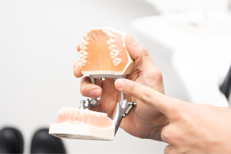 精密根管治療とは